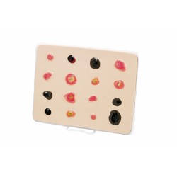 Huidkanker Onderzoeksmodel