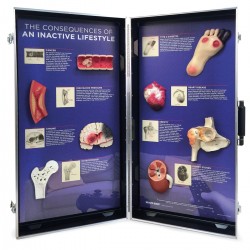 Inactieve Levensstijl Display