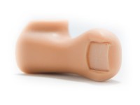 Ingegroeide Teennagel Model Ingegroeide Teennagel Model