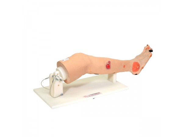 Oefenmodel Arterieel Vaatlijden Oefenmodel Arterieel Vaatlijden