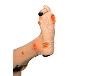 Oefenmodel Arterieel Vaatlijden Oefenmodel Arterieel Vaatlijden