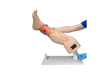 Oefenmodel Veneuze Insufficiëntie Oefenmodel Veneuze Insufficiëntie