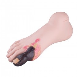 Voet met zweren voor Oefenpop