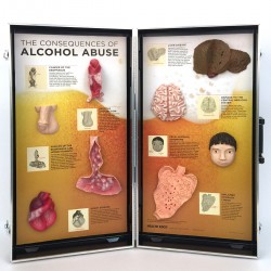 Gevolgen van Alcoholmisbruik, 3D Display