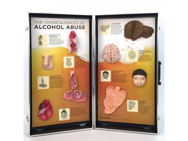 Gevolgen van Alcoholmisbruik, 3D Display