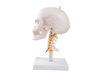 Schedel op cervicale wervelkolom