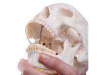 Schedel op cervicale wervelkolom