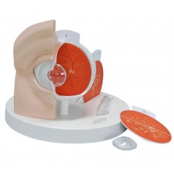 Oog met ziektebeelden