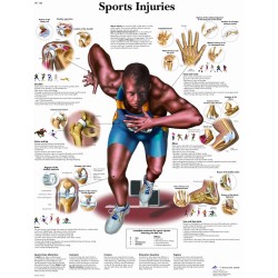 Anatomie Poster Sportblessures, papier Anatomie Poster Sportblessures, papier