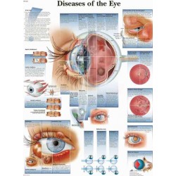 Anatomie Poster Ziektebeelden van het Oog, gelamineerd Anatomie Poster Ziektebeelden van het Oog, gelamineerd