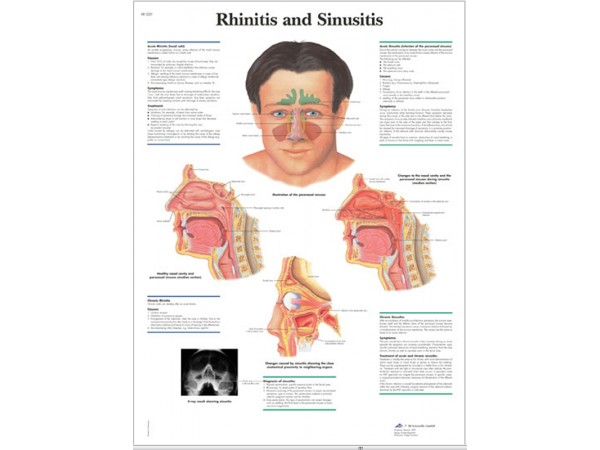 Rhinitis & Sinusitis, papieren wandplaat