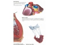 Anatomie Poster Hartziektes, gelamineerd