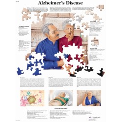 Alzheimer, papieren wandplaat Alzheimer, papieren wandplaat