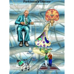 Parkinson, papieren wandplaat Parkinson, papieren wandplaat