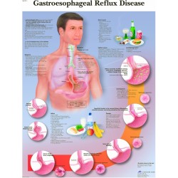 Reflux papieren wandplaat Reflux papieren wandplaat