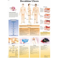 Anatomie Poster Decubitus, papier Anatomie Poster Decubitus, papier