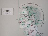 Points & Meridians of Acupuncture, wandplaat