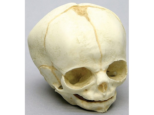 Foetus schedel 30 weken