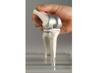 Knie-implantaat model