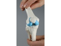 Knie-implantaat model