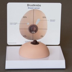 Borstkanker, zacht weefsel