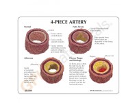 4-delig Arteriemodel + infokaart