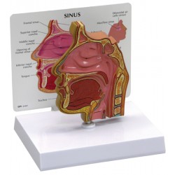 Sinus (schedelholte)