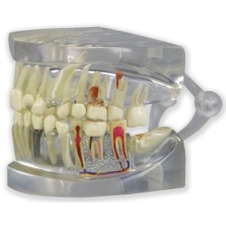 Transparant Kaakmodel met gebit