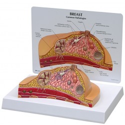 Doorsnede vrouwenborst