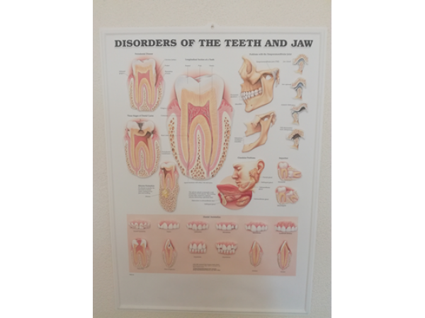 3D Reliëf Poster Aandoeningen aan Gebit en Kaak