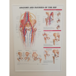 3D Reliëf Poster Anatomie en Blessures van de Heup 3D Reliëf Poster Anatomie en Blessures van de Heup