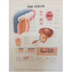 3D Reliëf Poster Het Gebit