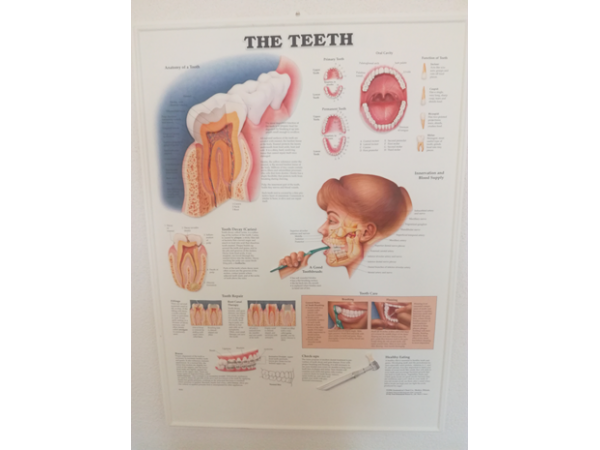 3D Reliëf Poster Het Gebit