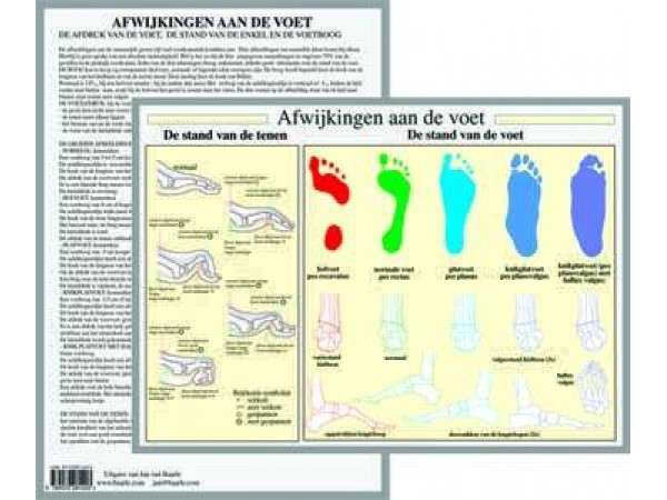 Afwijkingen aan de Voet A4 Kaart Nederlands