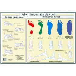 Afwijkingen aan de Voet Poster A2 Nederlands Afwijkingen aan de Voet Poster A2 Nederlands