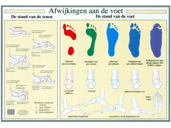 Afwijkingen aan de Voet Poster A2 Nederlands