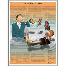 Alcoholverslaving Poster Gelamineerd
