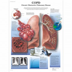 COPD Poster Gelamineerd