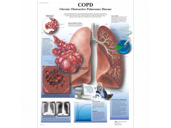 COPD Poster Gelamineerd