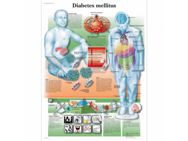 Anatomie Poster Diabetes, gelamineerd