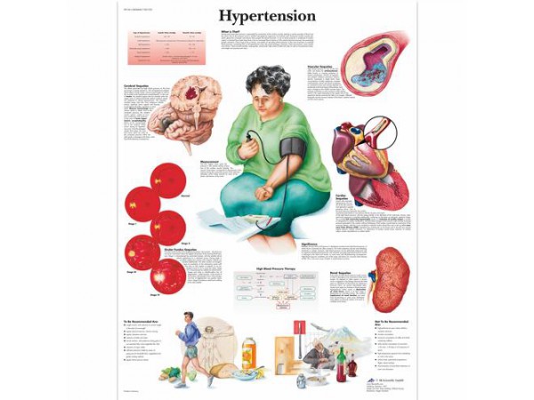 Hoge Bloeddruk (Hypertensie) Poster Gelamineerd