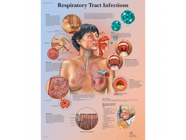 Luchtweginfecties Poster Gelamineerd