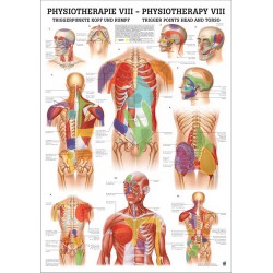 Triggerpoint Poster Hoofd en Romp Gelamineerd