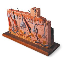 Huidmodel Serie met Brandwonden