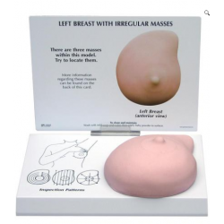 Linker Borstmodel met Onregelmatig Weefsel