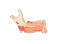 Onderkaakhelft, geavanceerd model,19-delig