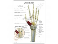 Hand/Pols met Carpaaltunnel syndroom