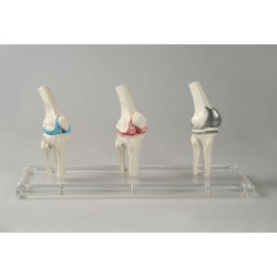 Knie-implantaat model Knie-implantaat model