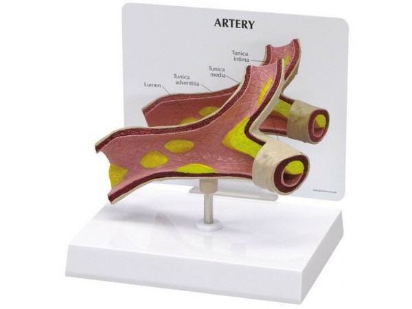 Arteriemodel met infokaart