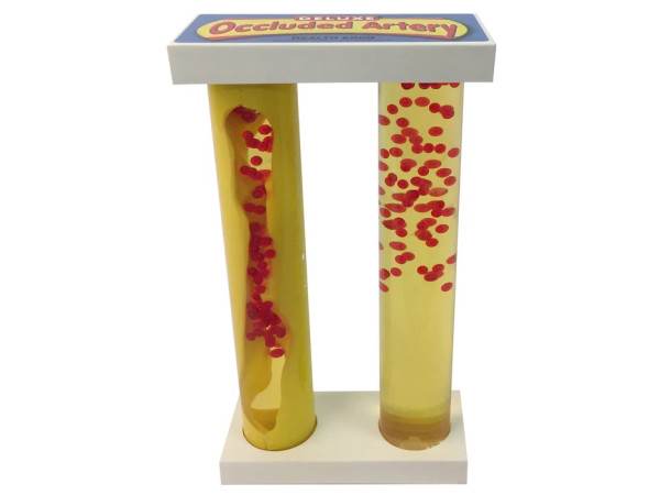 Deluxe Slagadermodel met aderververkalking